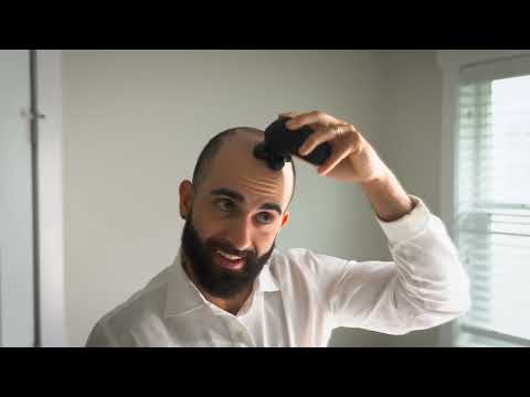 It's time to say goodbye to stubble, razor bumps and cuts with the BaldiePro electric head shaver!