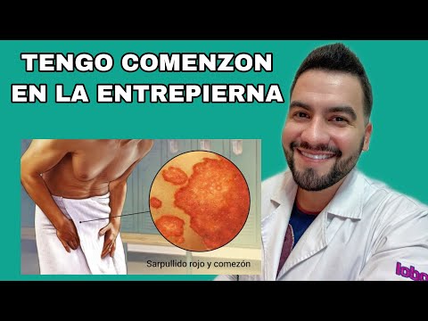 I have itchy red spots on my groin / Jock itch | Dr. David Campos