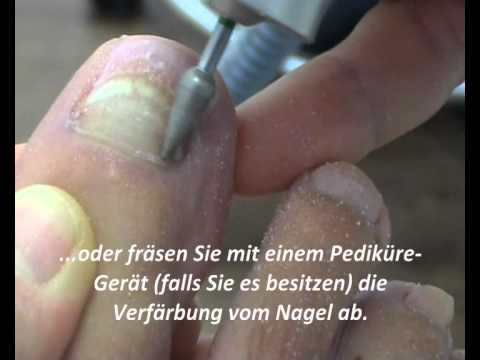 Diabetes Symptome bei Männern und Ernährung Bauchspeicheldrüse Insulin erhöht