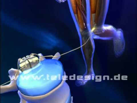 GN 011 Reflex  -SD PAL / GN 011 knee-jerk reflex -SD PAL