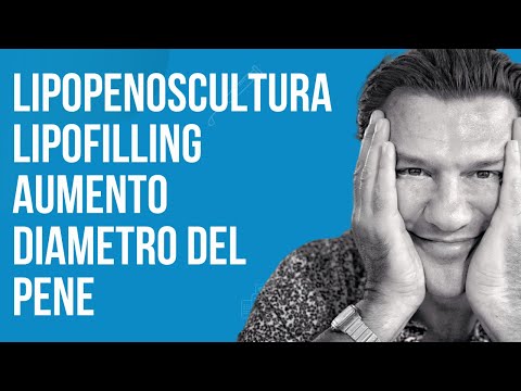 Patogeno femminile dove acquistare a Omsk Impatto sulla potenza di mentolo