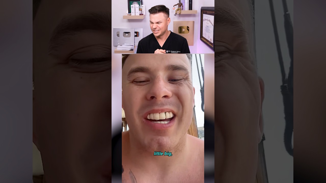 The Hidden TRUTH About Turkey Teeth! 😭🦷