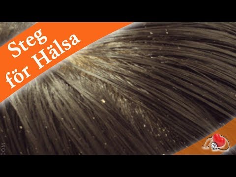 Naturläkemedel som bekämpar mjäll