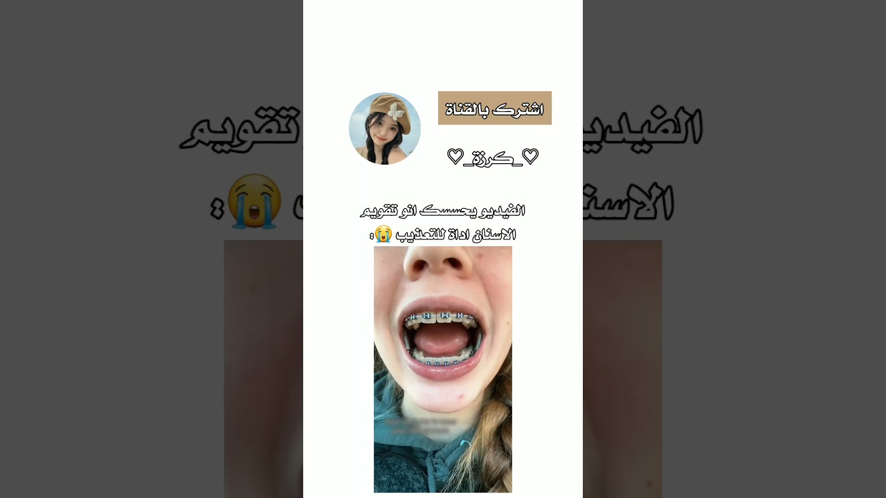 #shorts #explore #sabscribe #trending #kpop #twice #korea #joungkook #blackpink #kdrama #rose #fyp