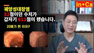 <Entity {'ja': '潰瘍性大腸炎の数値が32点だったのが、突然611点になりました。20倍に跳ね上がった理由は？', 'ko': '궤양성대장염 32점이던 수치가 갑자기 611점이 됐습니다 .  20배가 뛴 이유?', 'en': 'My ulcerative colitis score, which was 32, suddenly jumped to 611. Why did it spike 20-fold?'}>