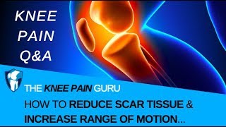 Knee Scar Tissue l How to Reduce Knee Scar Tissue & Increase Flexibility/Range of Motion?