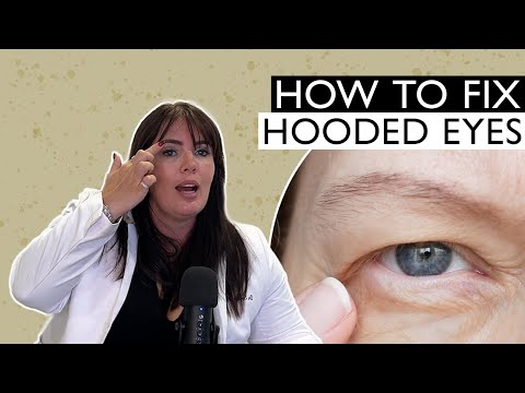Hooded Eyes: What are They and How to Fix Them Non-Surgically