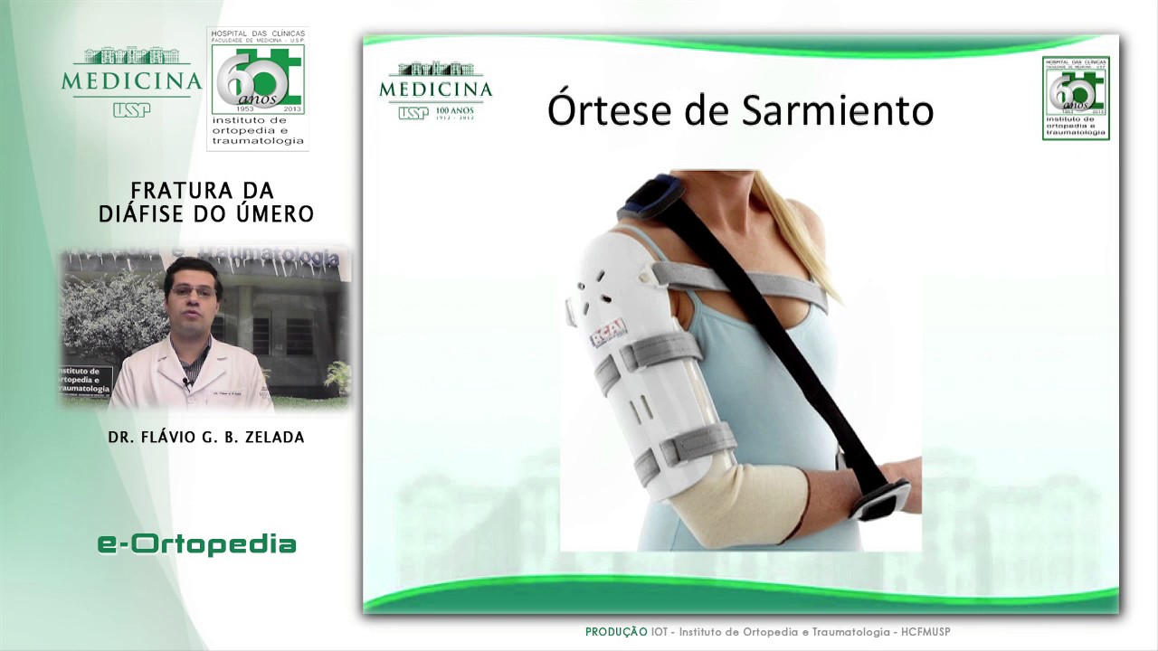 Fratura da Diáfise do Úmero - Dr. Flávio G.B. Zelada