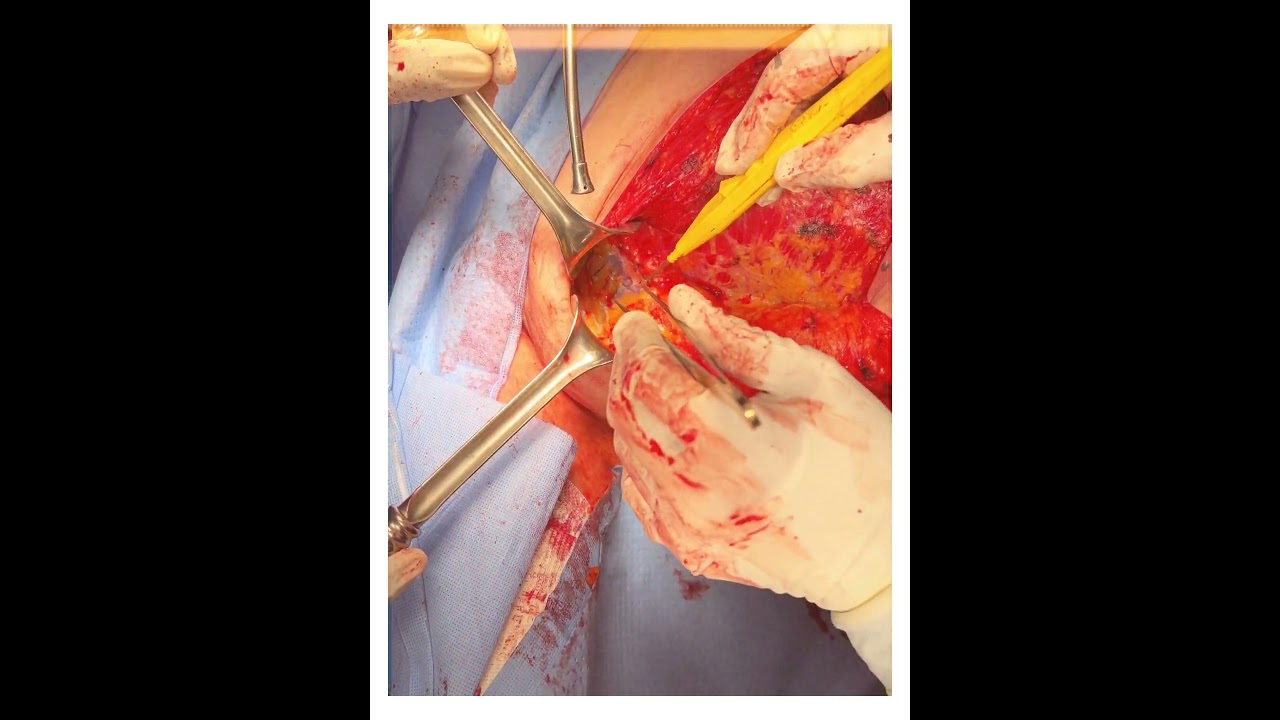 Ángel Millán Juárez-100