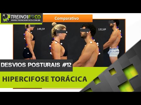 Può massaggiare con ernia intervertebrale La deposizione di sali nel trattamento delle articolazioni delle gambe rimedi popolari