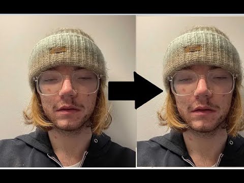 Wie ich meinen Entzug verschissen habe... | STORY [REUPLOAD]