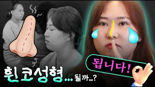 휜코 성형 될까? 그래서 티에스에 왔습니다