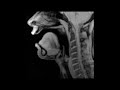 MRI Vowels