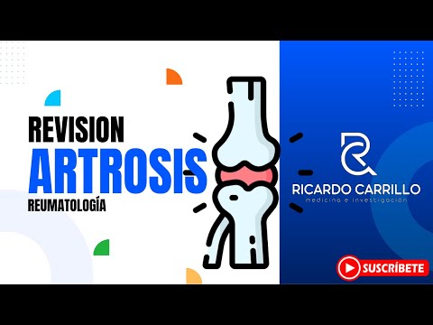 Osteoartrosis l Reumatología