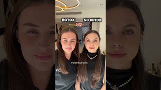 BOTOX VS NO BOTOX #antiaging #botulinumtoxin