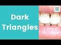 DARK TRIANGLES: what, why, and how to hide them l Dr. Melissa Bailey