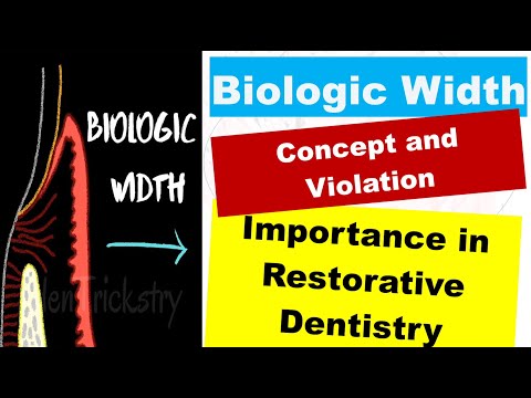 Biologic Width | Importance In Restorative Dentistry