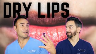 DRY CHAPPED LIPS: DERMATOLOGY TIPS