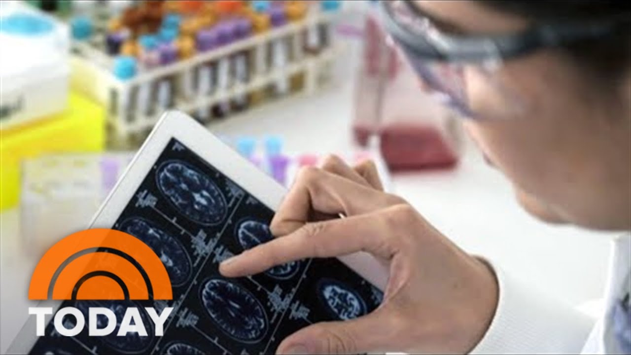 Experimental Alzheimer’s Drug Appears To Slow Cognitive Decline