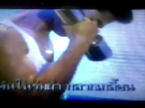 ไม่ว่าจะเป็นไปได้ที่จะไปอาบแดดถ้าโรคสะเก็ดเงินที่ รังสีรักษาโรคสะเก็ดเงิน