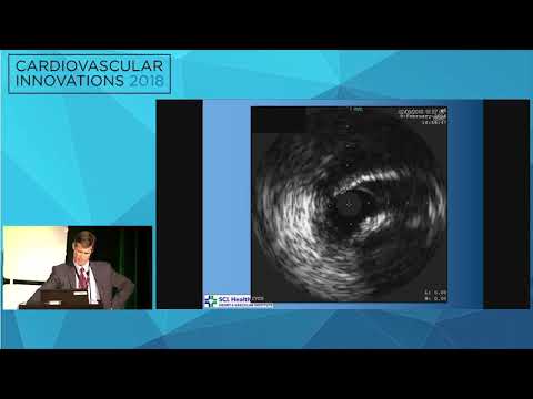CVI2018 Session: How I managed a difficult Lotus case - Will Anderson, MD