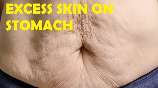 how to get rid of excess skin on stomach after weight loss