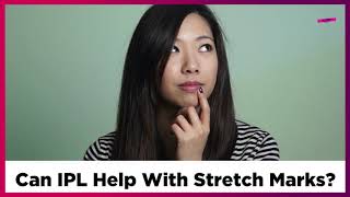 IPL For Stretch Marks: Will IPL Help Remove Stretch Marks?