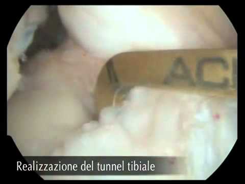 Dopo aver mangiato un lato sinistro dolorante sotto le costole e le mani nella parte posteriore Cartilagine liquida per le articolazioni pungere