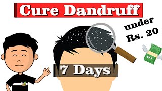 How to get rid of Dandruff in 7 Days ( Permanent cure for dandruff)
