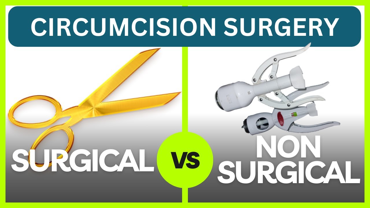 Surgical Vs Non Surgical Stitch less Circumcision Surgery?-Dr Kuber