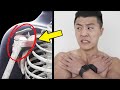 「肩膀别着」能是什么大问题?发现是肱骨错位后,我是真怕了!