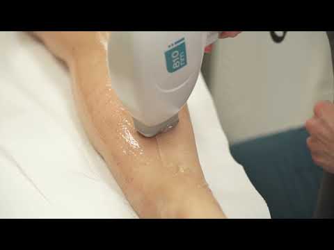 Diodenlaser Behandlung zur dauerhaften Haarentfernung | Healthy'Cent