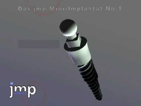 jmp Mini Implantat Animation