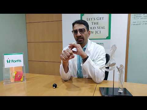 Hip Replacement by Dr Subhash Jangid