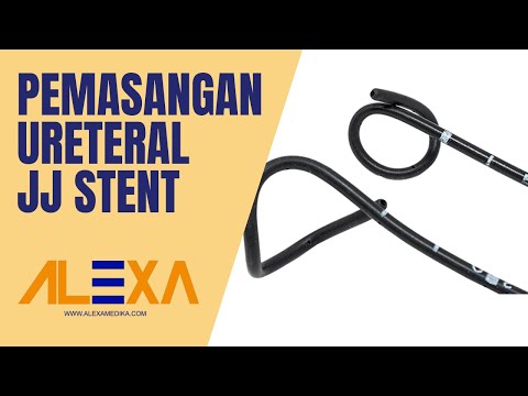 Pemasangan Ureteral Stent