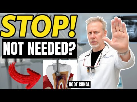 Before Getting a Root Canal Treatment… WATCH THIS