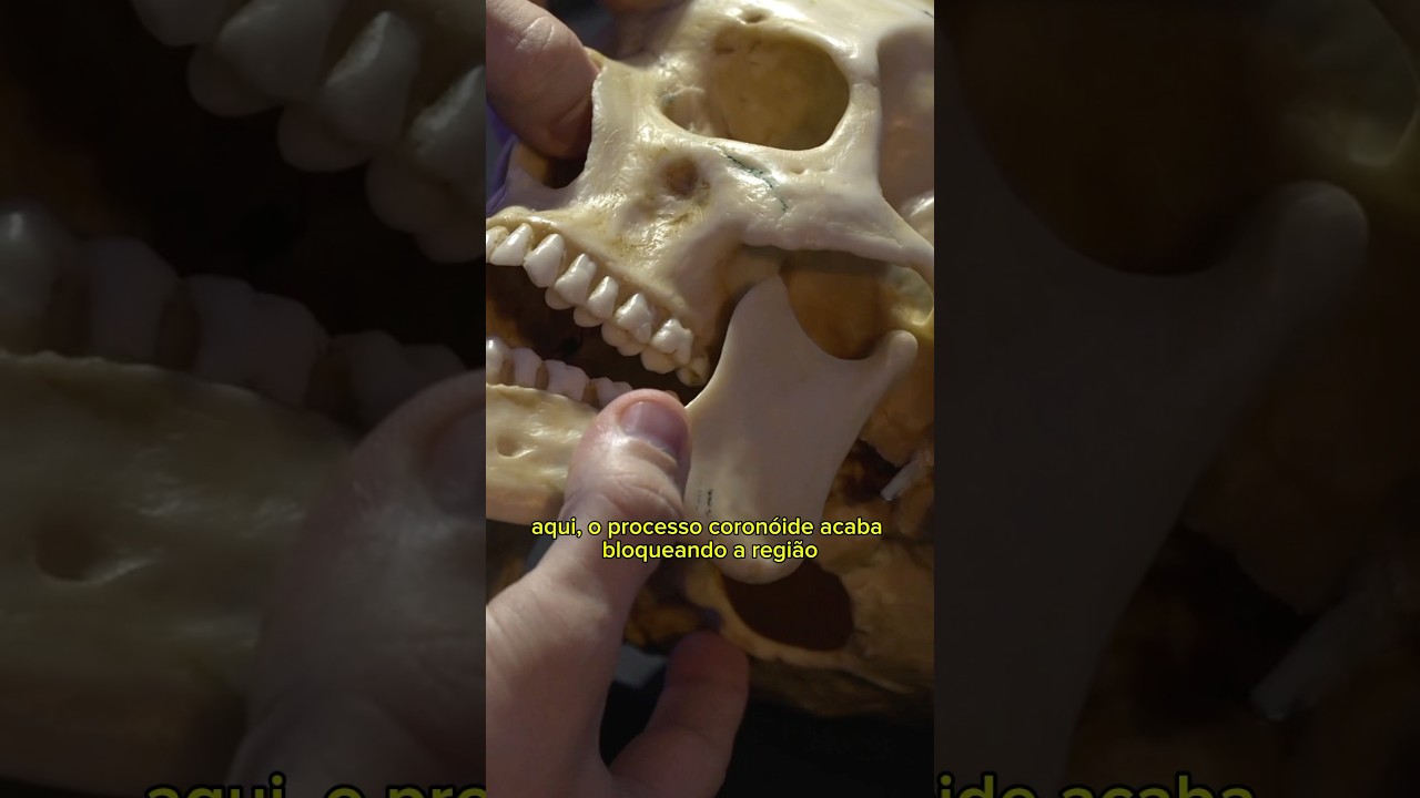 99% DOS ALUNOS E CIRURGIÕES-DENTISTAS NÃO SABEM DESSA INFORMAÇÃO! #anestesia #odontologia