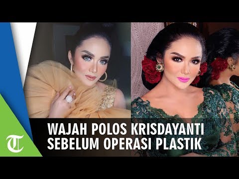 Inilah Wajah Polos Krisdayanti sebelum Operasi Plastik