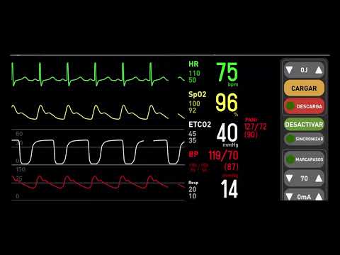 sonido ritmo cardiaco y desfibrilador