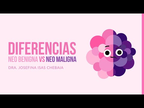 Diferencias de neoplasias benignas y malignas