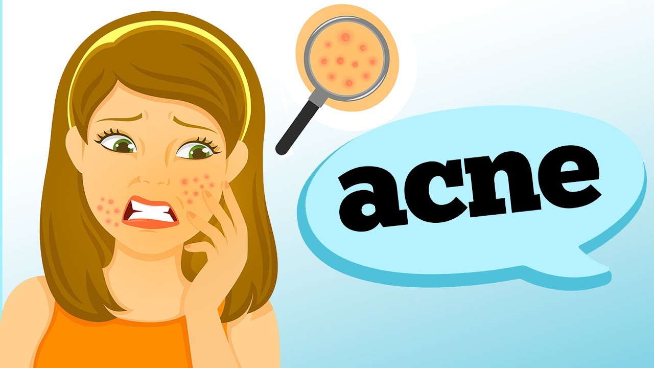 O QUE CAUSA ACNE?