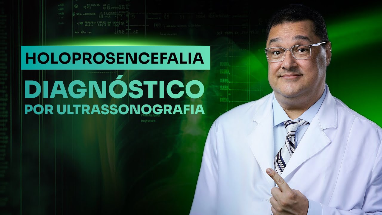 Holoprosencefalia: Diagnóstico por Ultrassonografia