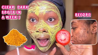 YOU WILL NEVER HAVE DARK SPOTS AGAIN | Get clear skin in a week using tomatoes & turmeric #skincare