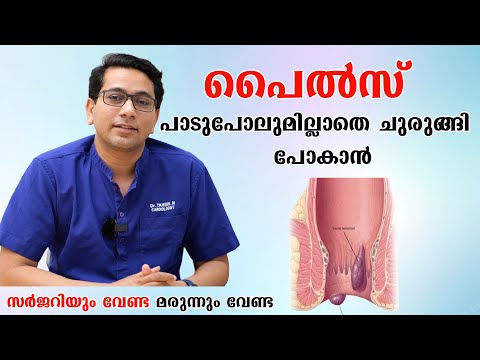 പൈൽസ് പാടുപോലുമില്ലാതെ ചുരുങ്ങി പോകാൻ  ,സർജറിയും വേണ്ട മരുന്നും വേണ്ട