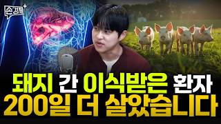 돼지 간 이식받은 환자 200일 더 살았습니다  - 박동현 과학동아 기자