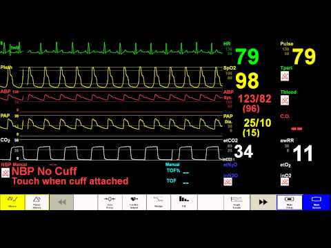 Simulated Patient Monitor - YouTube