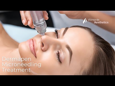 Dermapen Micro Needling Treatment of Acne Scars Animation by Needlelogic coms