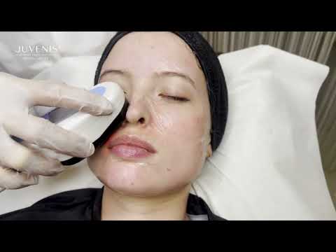 Schönheitsbehandlung: Ultraschall Gesichtsbehandlung für schöne Haut bei JUVENIS in Wien