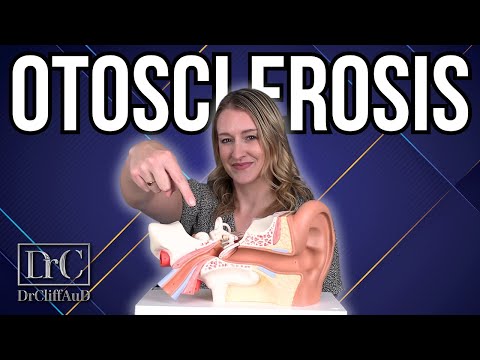 Do You Have Otosclerosis? | Diagnosis and Treatment Options