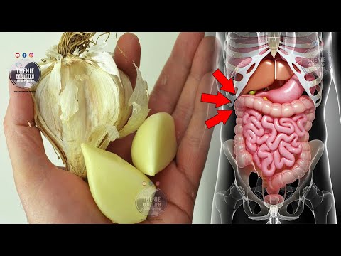 Vëmendje! Nuk duhet të hani hudhra nëse vuani nga këto 3 sëmundje